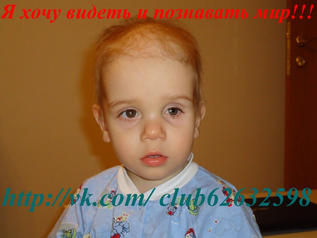 Рак Глаза У Ребенка Фото