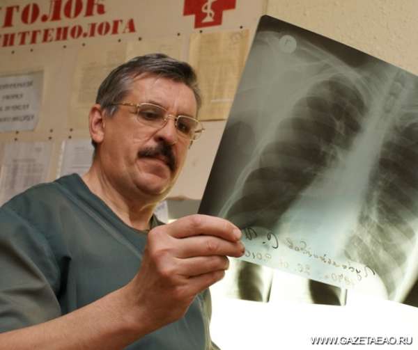 ЕАО входит в первую пятерку регионов России по уровню заболеваемости туберкулезом 