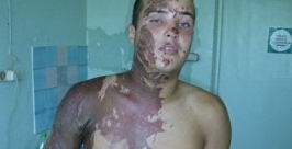 Пострадавший http://www.uralinform.ru/media/photo/big/nikita_1.jpg