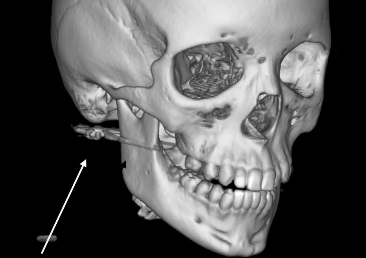 ТГ-канал Краевой клинической больницы №2
