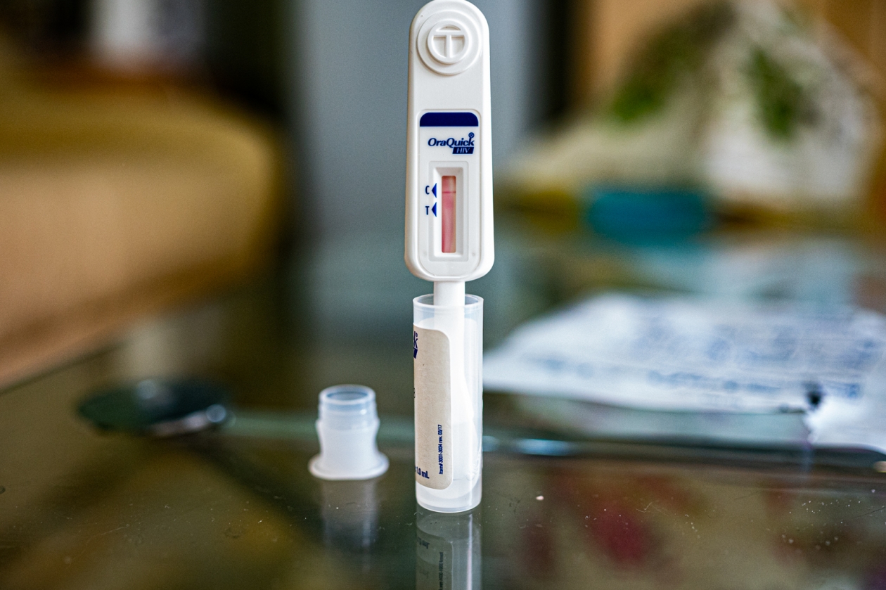 На Кубани зафиксировали резкое снижение новых случаев ВИЧ - KrasnodarMedia, 17.03.2026