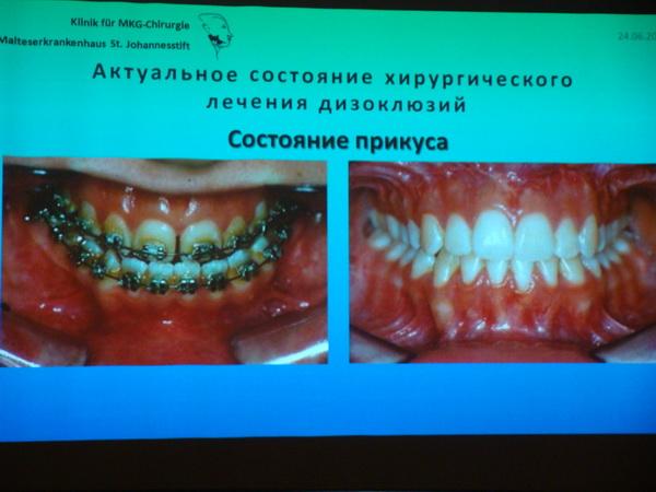 конференция по челюстно-лицевой хирургии стала очередным шагом в развитии медицины на Даль