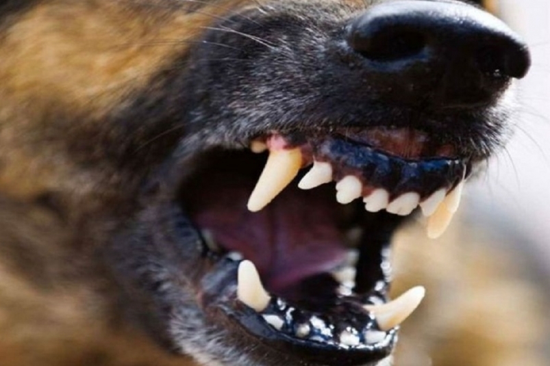 Председатель СКР заинтересовался нападением собаки на пенсионерку в Приморье